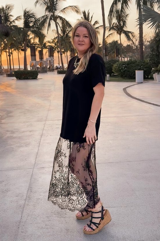 Stevie Dress 2